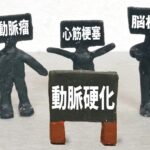 動脈硬化性疾患予防ガイドライン5年ぶり改訂、糖尿病など近年の日本の問題をカバー