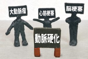 Amazon.co.jp: 動脈硬化性疾患予防ガイドライン 2017年版 : 日本