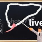 ALT>30をかかりつけ医受診の目安に、日本肝臓学会の奈良宣言