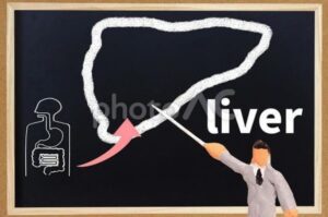 ALT>30をかかりつけ医受診の目安に、日本肝臓学会の奈良宣言