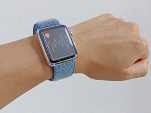 スマートウォッチを活用した新たな診療の可能性