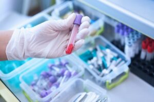 冬季の検査装置・試薬トラブル対策ガイド