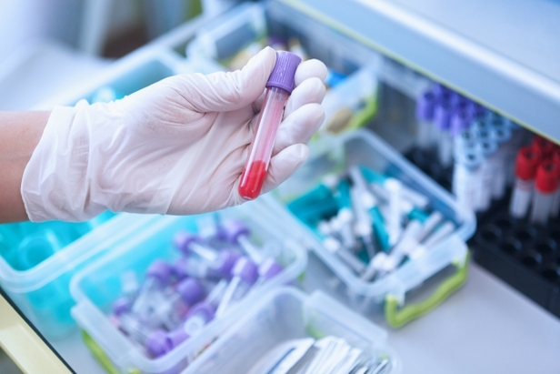 冬季の検査装置・試薬トラブル対策ガイド